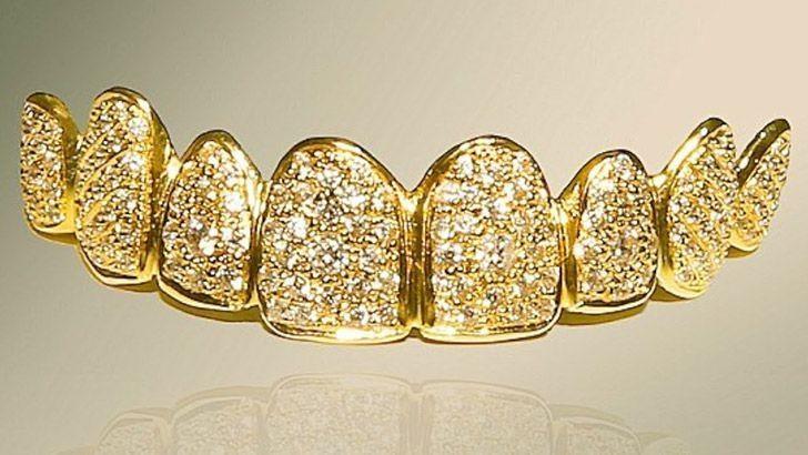 Diamond encrusted false teeth